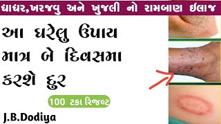 ખાજ ખુજલીનો કાયમી ઈલાજ l dhadhar skin problem solution in gujarati l helth tips l desiupchar [upl. by Whetstone]