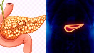 What is Fatty Pancreas Symptoms Causes Treatment [upl. by Auohc]