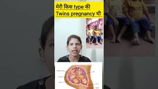 meri kis type ki twins pregnancy thi dichorionic diamniotic twins pregnancy ka kya matlab hota hai [upl. by Adnovahs]