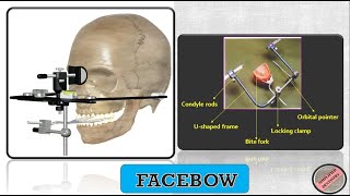 Facebow  Types and Parts of a Facebow [upl. by Osana]