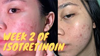 2 WEEKS AFTER TAKING ISOTRETINOIN Real updates  Purging is REAL pa rin [upl. by Netneuq652]