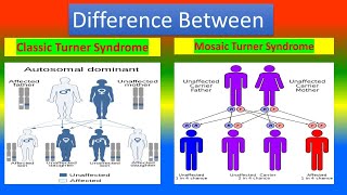 Classic Turner Syndrome and Mosaic Turner Syndrome [upl. by Ko307]