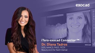 Revolutionizing Collaboration with the iTeroexocad Connector™ [upl. by Aneled]