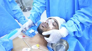 Man smoothly Wakes up after Surgery  Anesthesia Extubation [upl. by Nilhsa]