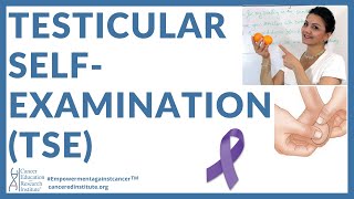 Cancer Education video HOW TO DO TESTICULAR SELFEXAMINATION TSE DETECT TESTICULAR CANCER EARLY [upl. by Drexler]