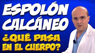 ESPOLÓN CALCÁNEO  ¿Qué pasa dentro del cuerpo de las personas que lo padecen [upl. by Devy]