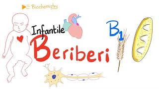 Infantile Beriberi  Vitamin B1 Deficiency  Thiamine Deficiency [upl. by Selemas]