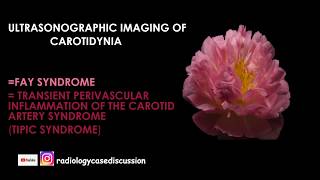 47ULTRASONOGRAPHIC IMAGING OF CAROTIDYNIA  FAY SYNDROME  TIPIC SYNDROM [upl. by Ellohcin]