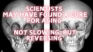 Scientists may have found a cure for aging [upl. by Darci598]