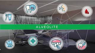 Alvéolite dentaire  étiologie  symptômes et traitement dentist [upl. by Nodnelg]