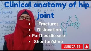 Clinical anatomy of hip joint  fractures dislocations perthes disease Shentons line lower limb [upl. by Egide]