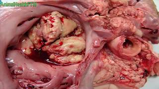 الإلتهاب القلبى الوغزى 12 Traumatic Pericarditis [upl. by Carolan351]