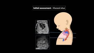 Fetal Echocardiography Protocol and Technique [upl. by Martica563]