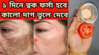 ফর্সা হবার সহজ উপায়েforsa howar sohoj upaytomato facialGlow Facial [upl. by Nodal570]