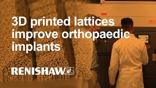 3D printed lattices improve orthopaedic implants [upl. by Haimes422]