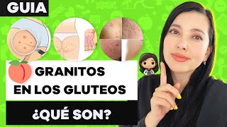 ¿Tienes GRANITOS en los GLÚTEOS TE CUENTO SOBRE FOLICULITIS [upl. by Michail]