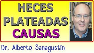 HECES PLATEADAS ▶ ¿Sabes las Causas [upl. by Rinaldo]