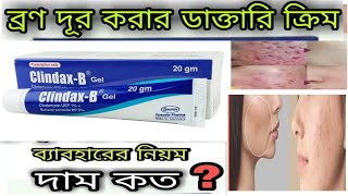 ব্রণ দূর করার ডাক্তারি জেল  clindax b gel clindax b gel review  All Skin problemsolved youtuber [upl. by Gabriele87]