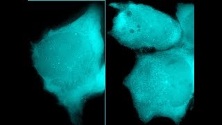 Firstever live tracking of HIV1 based lentiviral vectors in human cells [upl. by Ley872]