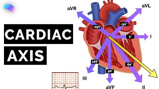 Cardiac Axis Explained  ECG  EKG  OSCE Guide  UKMLA  CPSA  PLAB 2 [upl. by Forras]