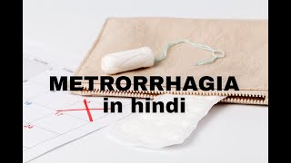 Metrorrhagia in Hindi obsgyne abnormal uterine bleeding mbbsstudy obsgyne [upl. by Lindgren65]