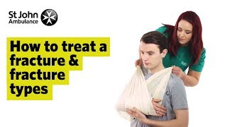 How To Treat A Fracture amp Fracture Types  First Aid Training  St John Ambulance [upl. by Maddie614]