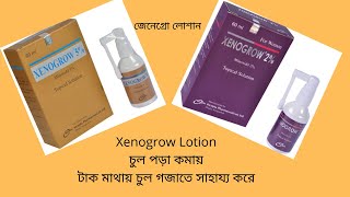 Xenogrow Sclap Lotion  Minoxidil 2 And 5  Xenogrow Full Review In Bangla [upl. by Naltiak]