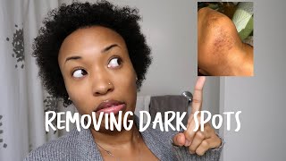 How to Clear Up Dark Spots  Removing Dark Spots on Your Face  Earthen Escapes Dark Spot Corrector [upl. by Perusse408]