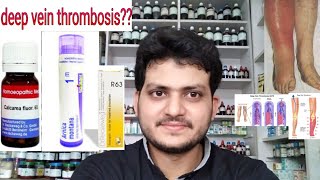 Deep vein thrombosis Homeopathic medicine for Deep vein thrombosis [upl. by Darn]