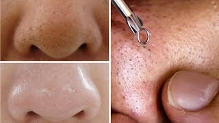 How To Do Facial Clean Up At Home Step By Step For Spotless Clear Skin Rabia Skincare [upl. by Tam]