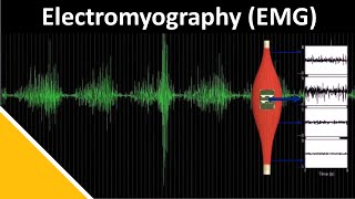 EMG Electromyography in Biomechanics  Delsys [upl. by Harts]