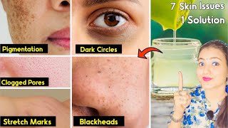 7 in 1 Skin Challenge  Skin Ki मुश्किल समस्या जैसे झाइयाँ PIGMENTATION PORES का 100 इलाज़ सिर्फ💕 [upl. by Saxela]