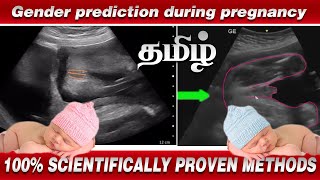 Gender prediction during pregnancy in Tamil  100 Scientific Proven Method  Nithya Arunkumar [upl. by Henley129]