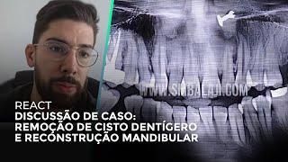 REMOÇÃO DE CISTO DENTÍGERO E RECONSTRUÇÃO MANDIBULAR  DISCUSSÃO DE CASO [upl. by Ernie]