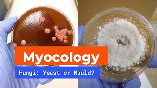 Microbiology Mycology  Yeast and Mould [upl. by Yancey]