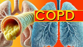 COPD Explained How to Spot Early Symptoms Before Its Too Late [upl. by Cathie]