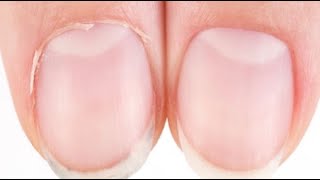 HOW TO CUT CUTICLE  NAIL PREP SATISFYING [upl. by Lladnyk497]