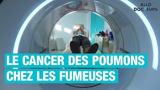 Cancer du poumon  fautil un dépistage pour toutes les fumeuses [upl. by Odracer602]