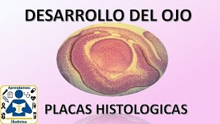 Embriologia Desarrollo de ojo Placas histologicas [upl. by Chad280]