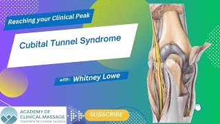 Cubital Tunnel Syndrome [upl. by Sager866]