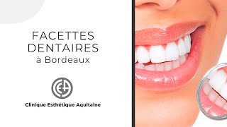 Facettes dentaires  Clinique Esthétique Aquitaine [upl. by Oigimer]