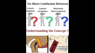 Understanding the Concept of Centric Relation Centric Occlusion Maximum Intercuspation [upl. by Godard683]