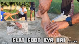 What is Flat FootFlat Foot Kya HaiMedical Test Flat Foot 2023 101 Problem Solve Defence Medical [upl. by Eivi]