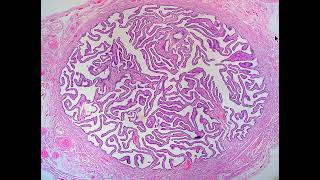 Practical histology of fallopian tubeamp vagina [upl. by Solenne]