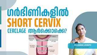 Short cervix പ്രശ്നമോ Cerclage എപ്പോൾ വേണം  DRSUSAN JOSEPH [upl. by Zach]