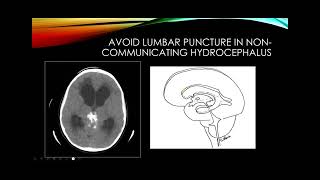 Cerebrospinal fluid [upl. by Elliott]