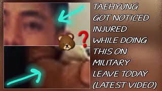 OMG😱💋Taehyung Got Noticed Injured While Doing This On Military Leave TodayNewtaehyungjungkook [upl. by Chaim]