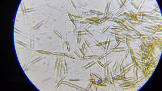 Marine Diatoms under the microscope [upl. by Ellezaj]