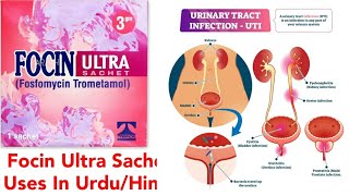 Focin Ultra Sachet uses in Urdu  Hindi [upl. by Erny]