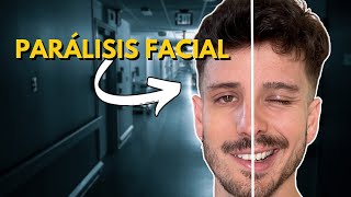 Qué Hacer si Tienes PARÁLISIS FACIAL  Tratamiento y Consejos [upl. by Kesley841]